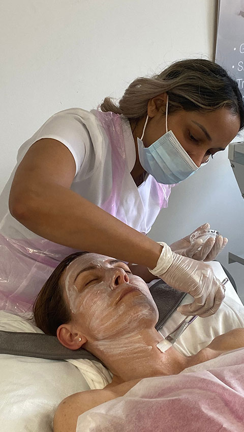 Acne and Age Spots being treated with chemical peel