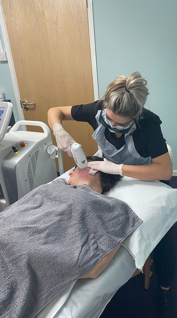 Laser hair removal treatment in progress at Skinphony Clinic MK