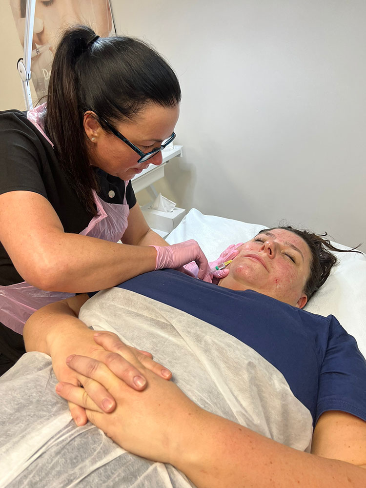 Mesotherapy treatment by Skinphony therapist